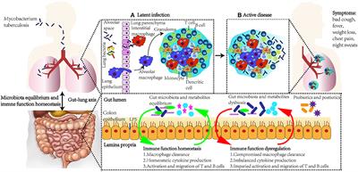 Microbiota and Tuberculosis: A Potential Role of Probiotics, and Postbiotics